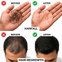 Regrow F5