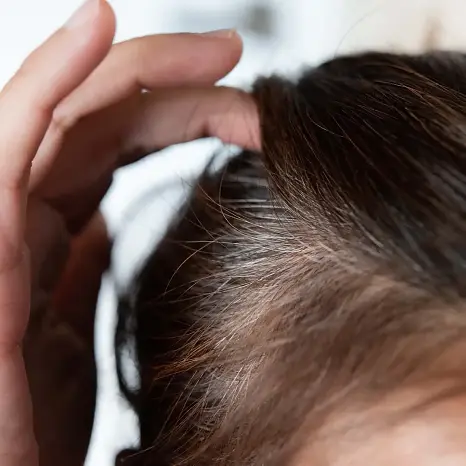 Don’t Panic: Stage-Wise Hair Thinning Routine for Men (2026 Guide)