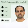 Regrow 10% – Advanced Hair Regrowth Spray for Thinning Hair
