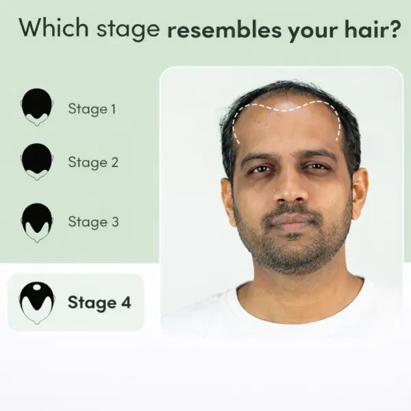 Regrow 10% – Advanced Hair Regrowth Spray for Thinning Hair