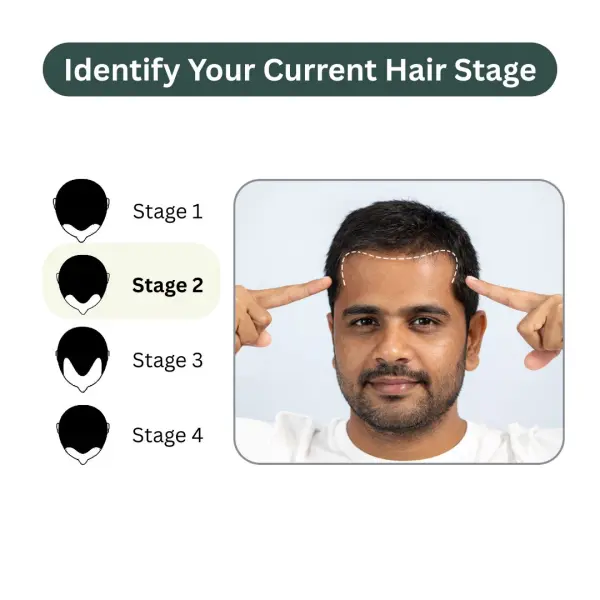Regrow 5% - Hair Regrowth Spray for Fuller, Thicker Hair